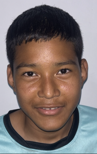 Diego Carmona