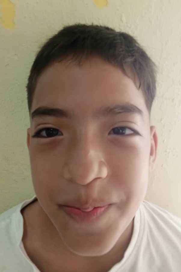 Alhan Rojo