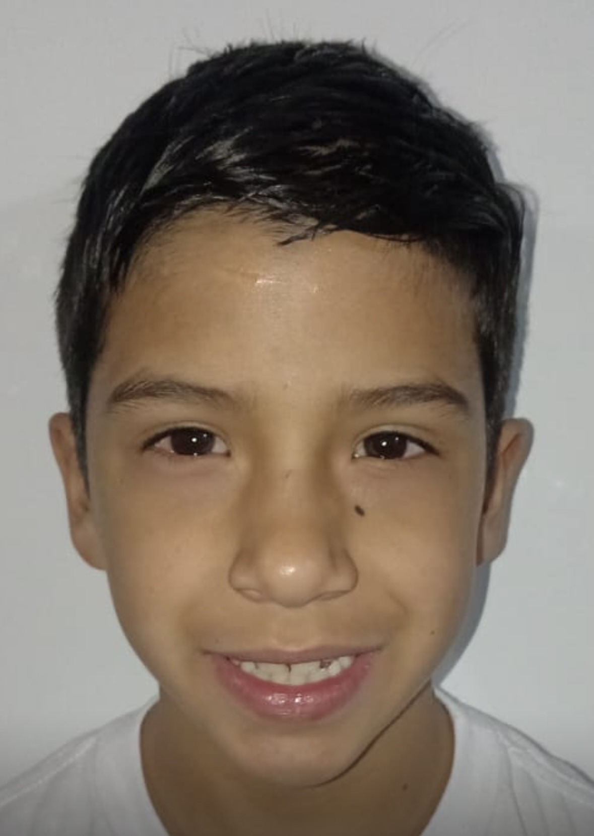 Matías Torres